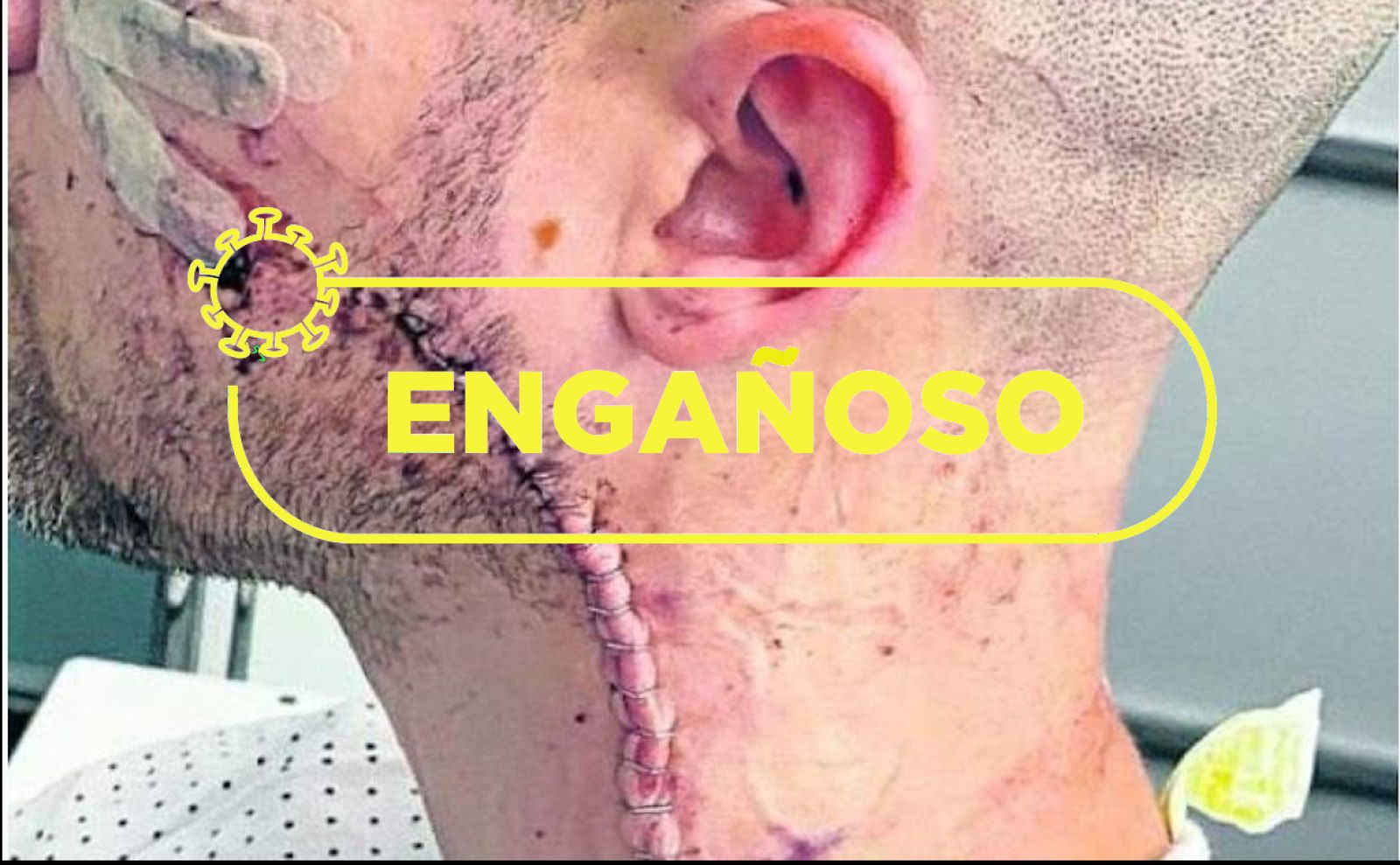 No, el policía local herido en un bar de Bilbao no fue atacado por motivos ideológicos, su agresor tenía antecedentes y estaba ebrio