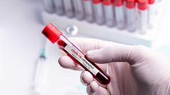 Investigadores españoles desarrollan un test de anticuerpos con una fiabilidad del 98%