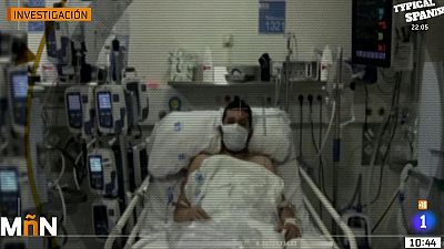 El 44% de los pacientes de coronavirus que pasaron por la UCI necesitarn ayuda psicolgica