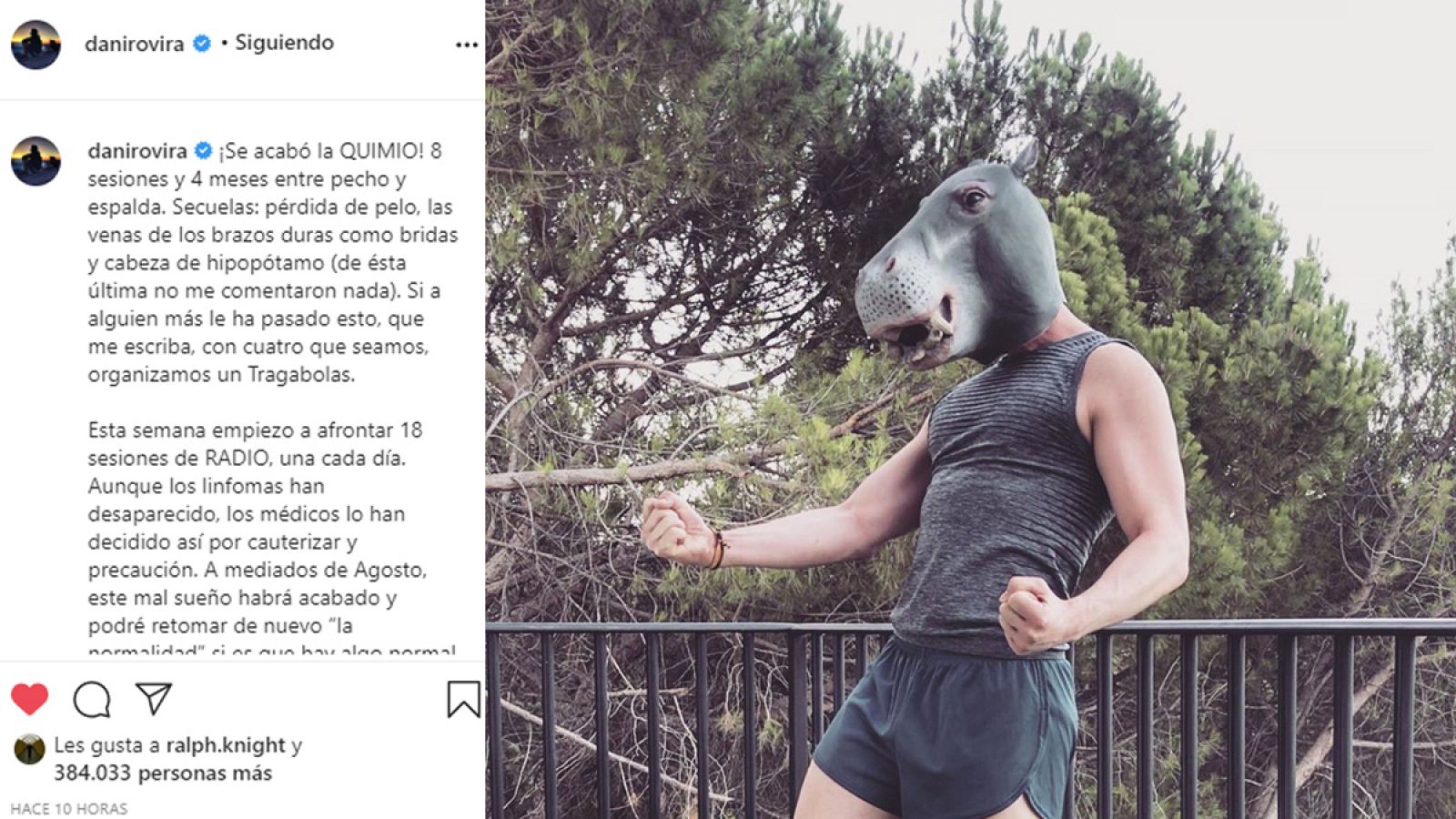 Dani Rovira termina la quimio