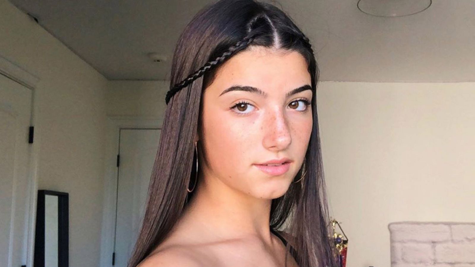 Charlie D'Amelio desvela que sufre un desorden alimenticio