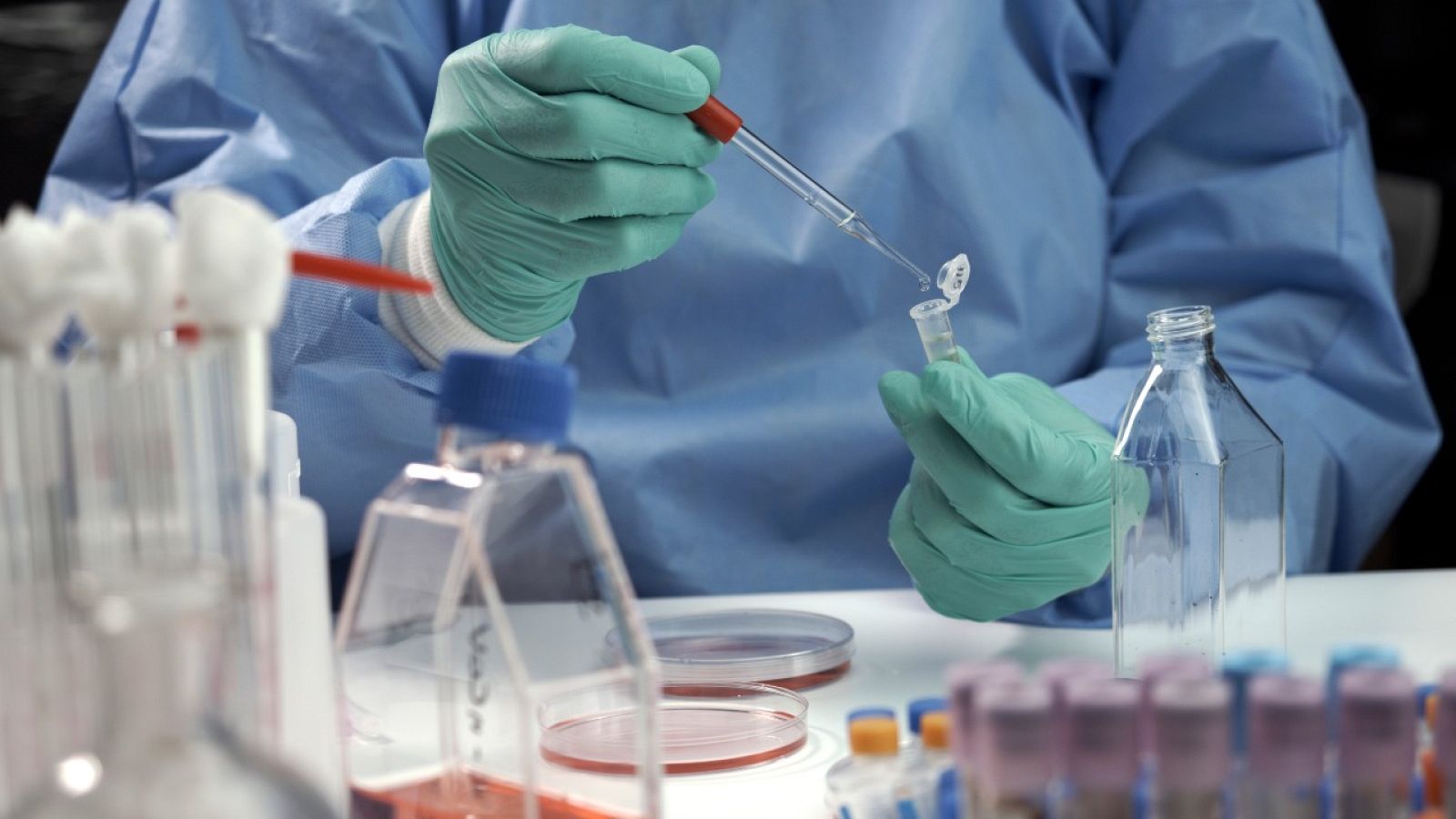 El CSIC diseña un test de anticuerpos del coronavirus más sensible y fiable