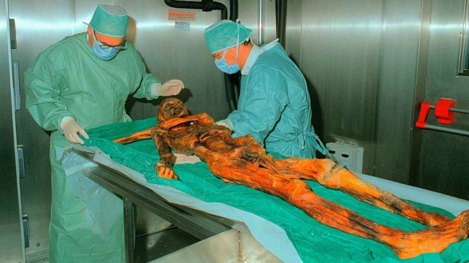 Ötzi examinado por los forenses