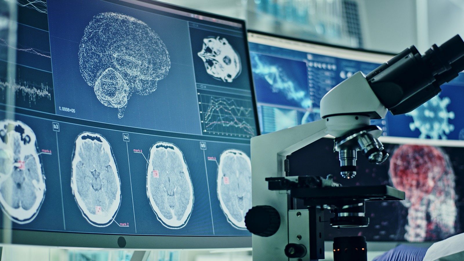 El estudio del cerebro desde el laboratorio, en una imagen de archivo