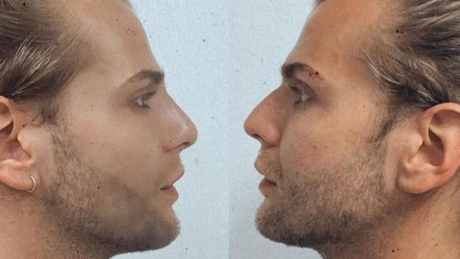 Todos los retoques de Eduardo Navarrete