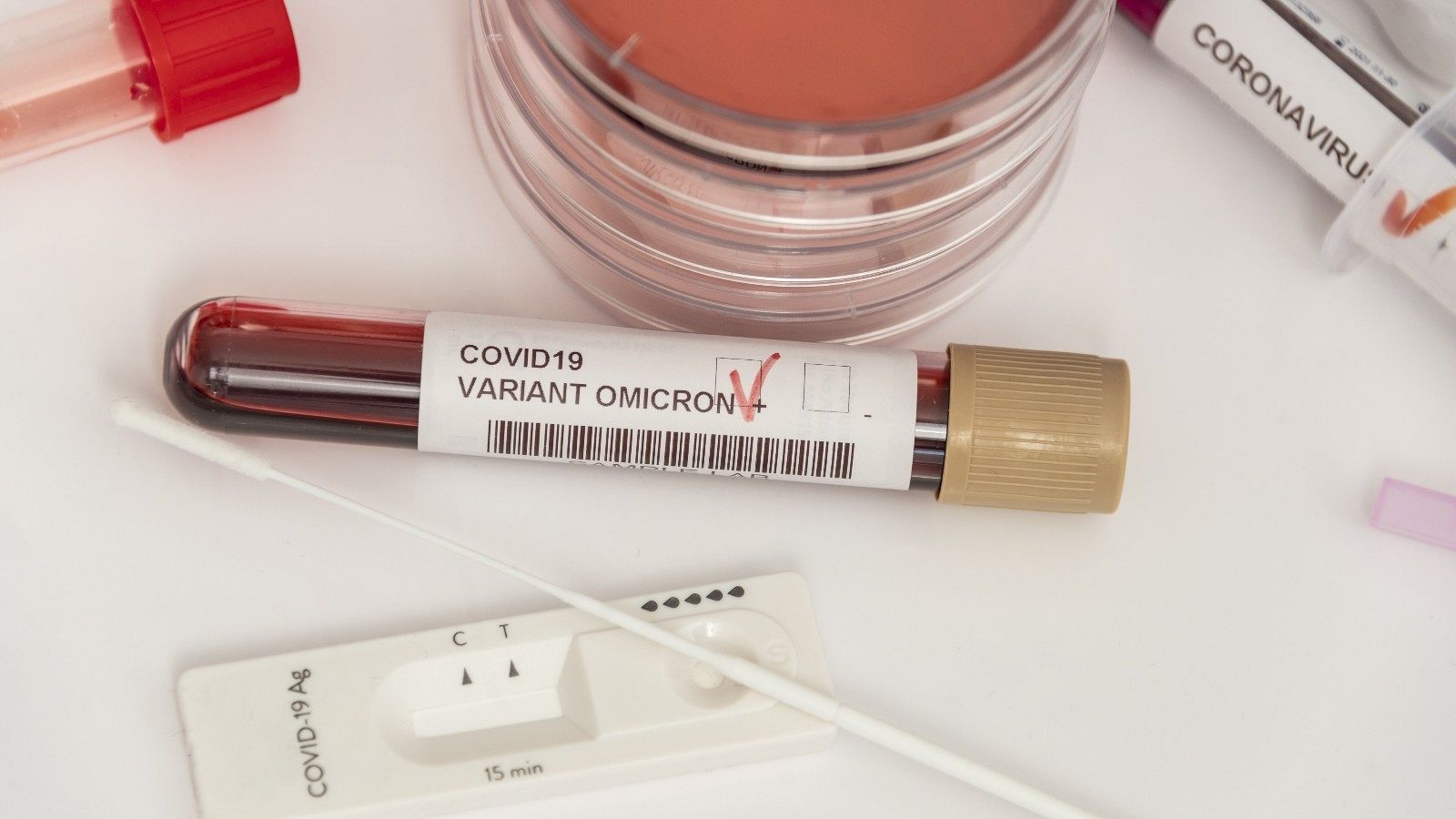 Muestras de sangre y pruebas de antígenos para detectar el coronavirus