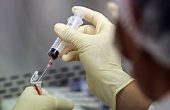 El cáncer causó 7,6 millones de muertes en 2007 y su incidencia se ha duplicado en 30 años