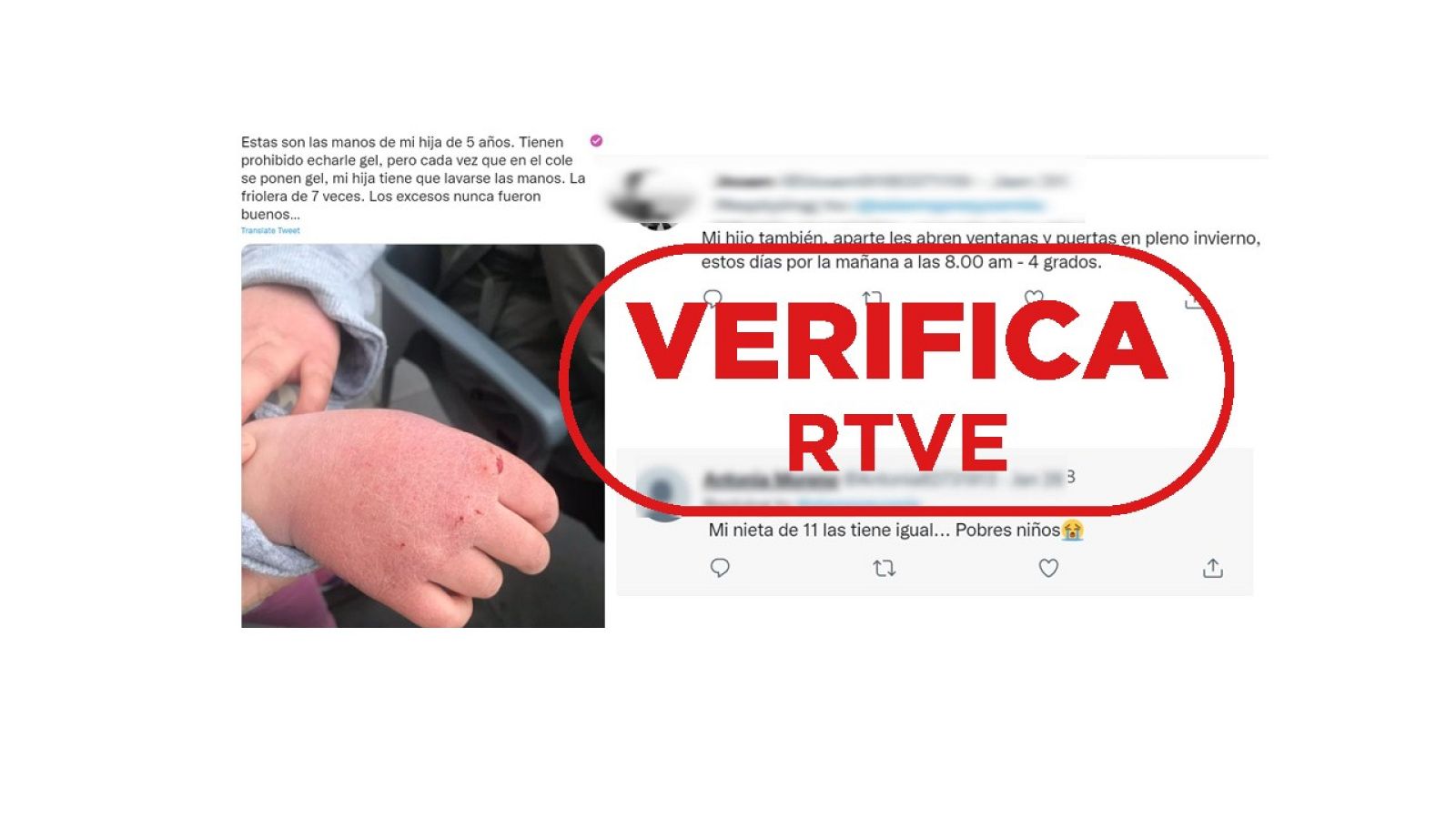 Tuits sobre las medidas de higiene en los colegios con la foto de unas manos dañadas