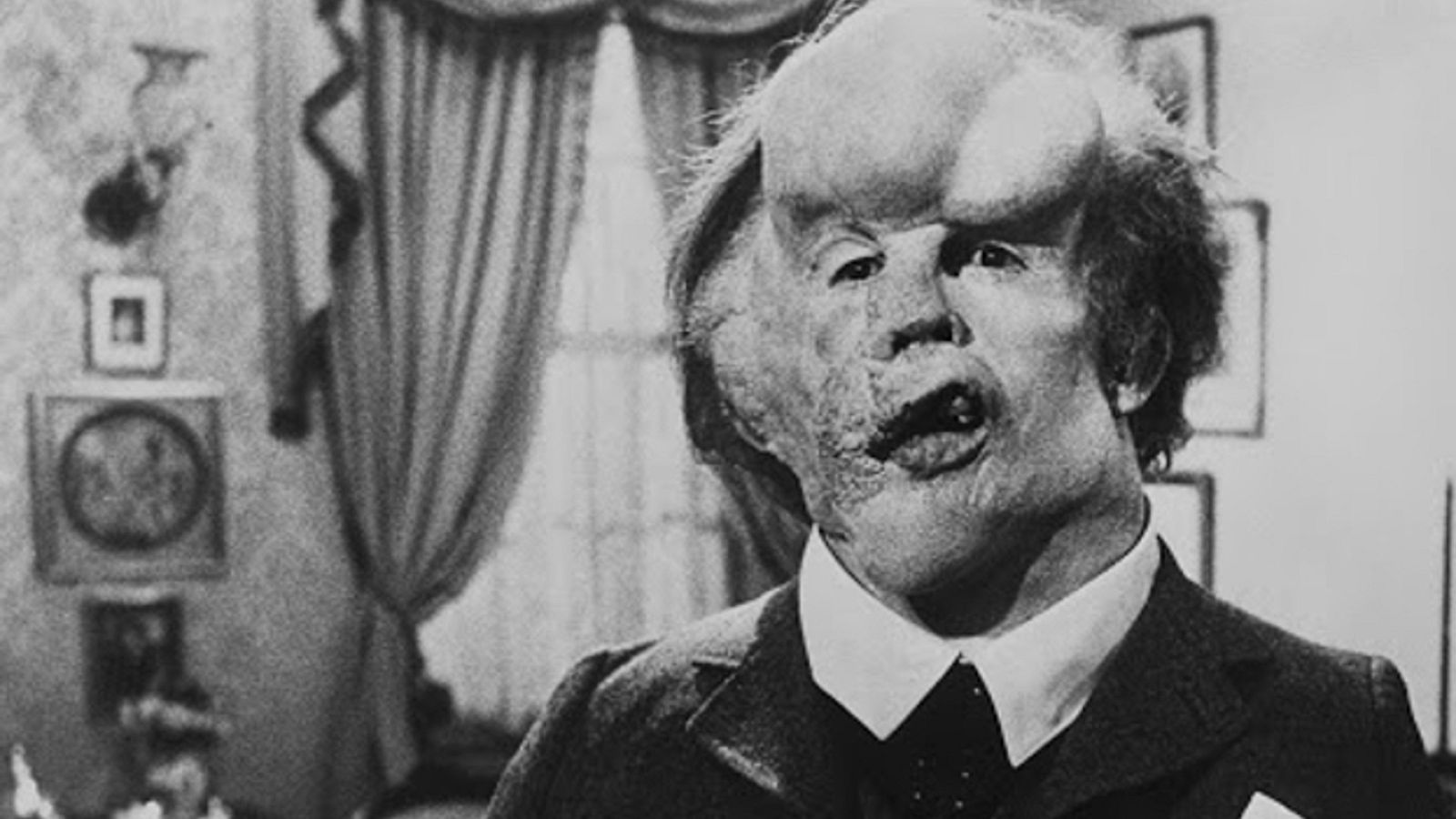 Joseph Carey Merrick en 1889.