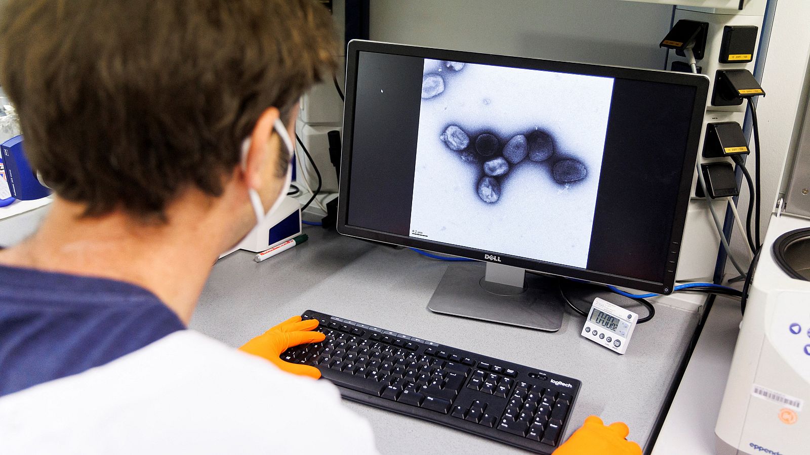 Un científico observa el virus de la viruela del mono en un laboratorio.