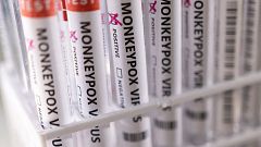 Sanidad eleva a 233 los casos de viruela del mono en España tras confirmar ocho nuevos positivos