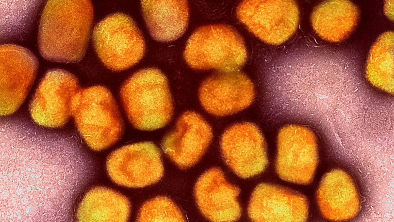 Microfotografia acolorida de partícules del virus de la verola del mico a partir de cultiu cel·lular