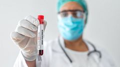 Sanidad confirma la segunda muerte por viruela del mono en España