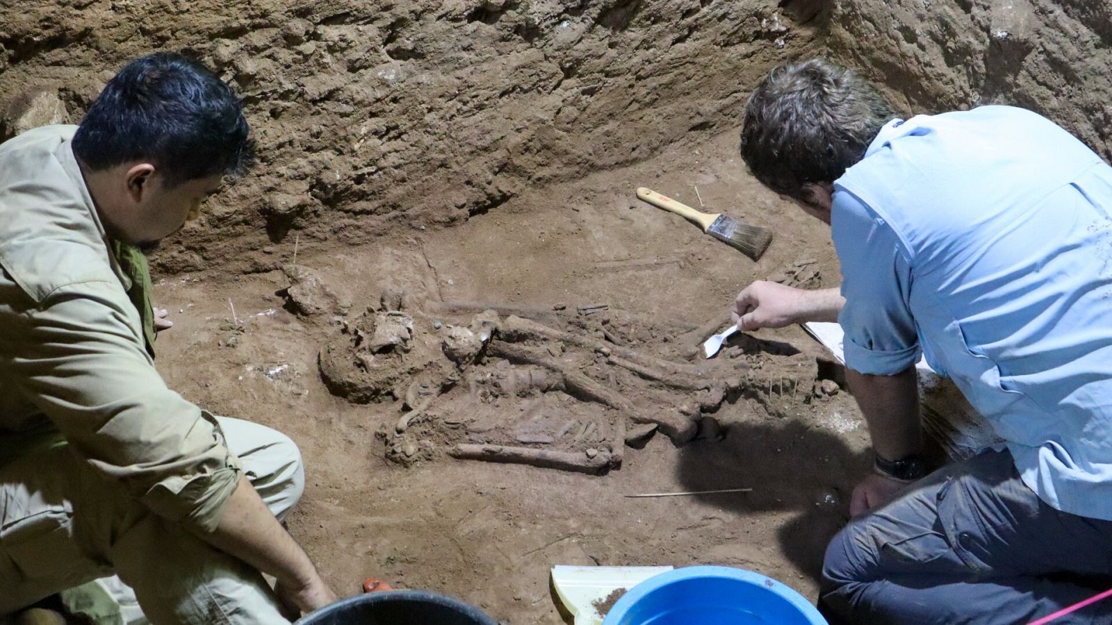 La amputación quirúrgica más antigua se realizó a un niño hace 31.000 años