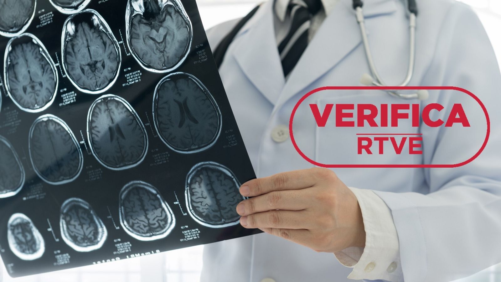 En el Día mundial del ictus analizamos su relación con la Covid-19