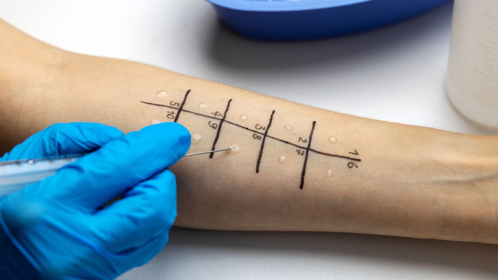 Prueba de la alergia