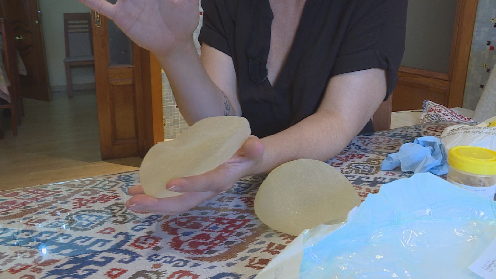 Beatriz nos muestra los implantes mamarios que tuvo que explantarse