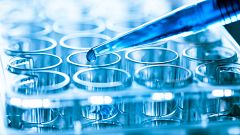Identifican dos nuevos genes asociados a un mayor riesgo de alzhéimer