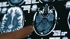 La línea de teléfono de 'Espacio Alzheimer' está activa en toda Andalucía