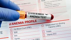 ¿Contribuye la leche y los yogures a la anemia?