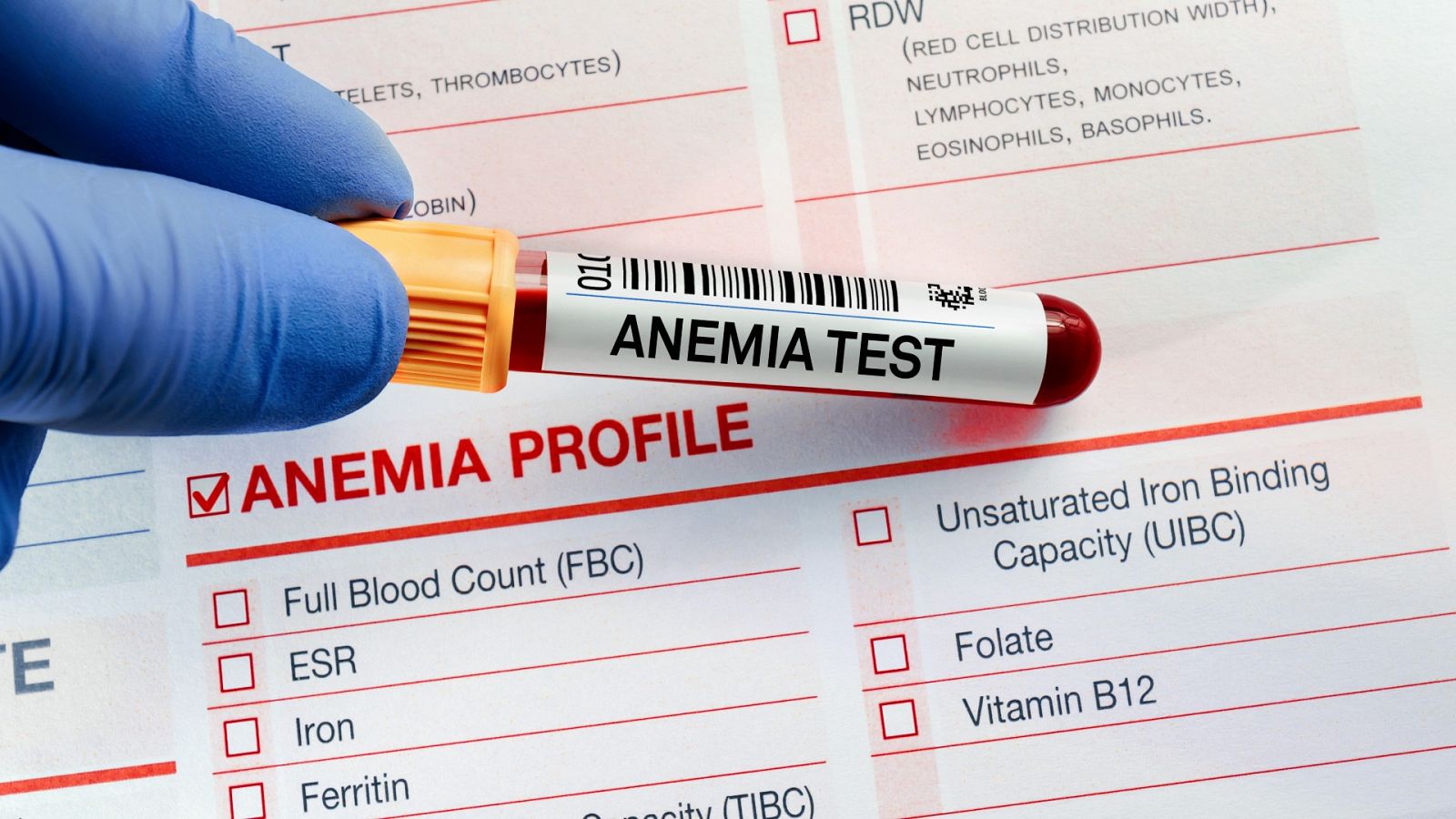 ¿Contribuye la leche y los yogures a la anemia?