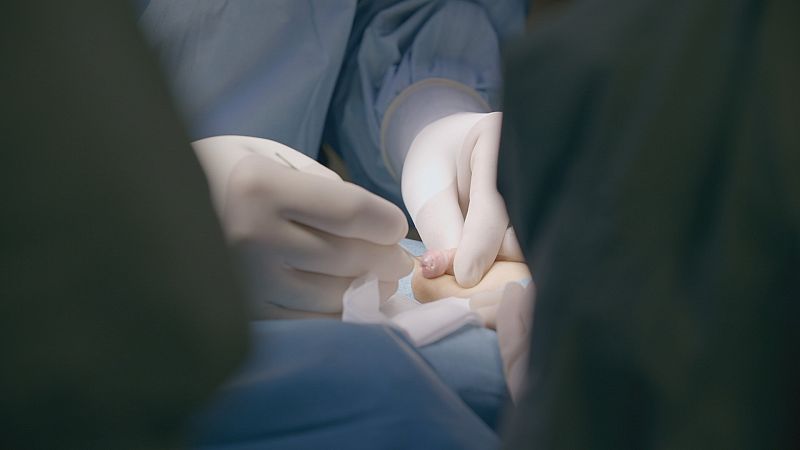 Circuncisión, ¿se están subestimando sus riesgos?