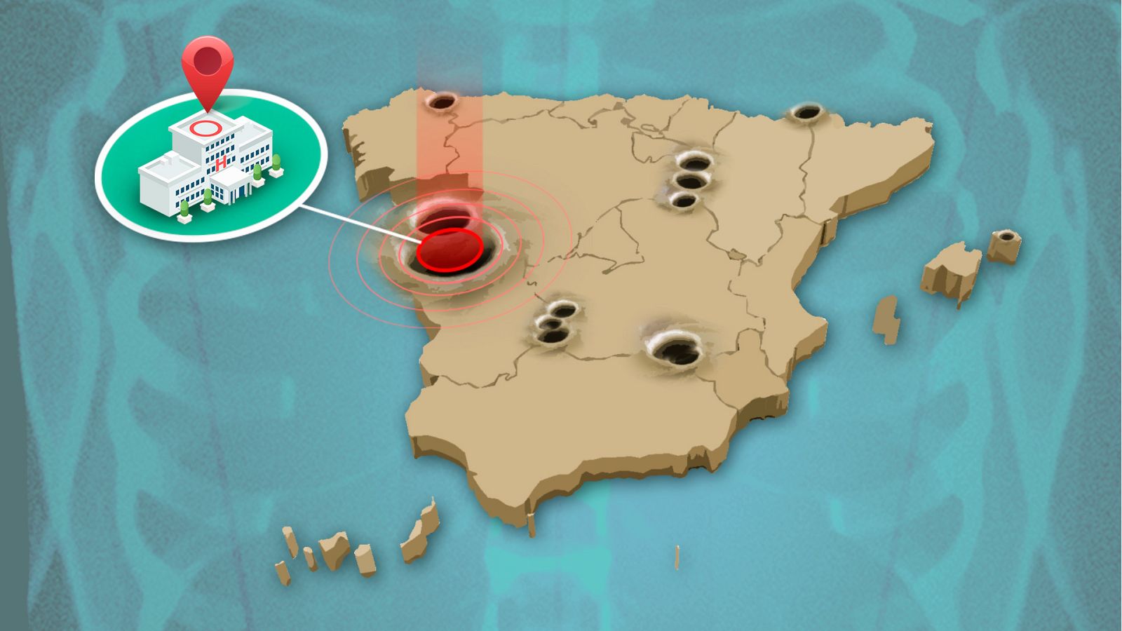 La cuarta parte de los hospitales públicos de España se concentran en Madrid y Cataluña.