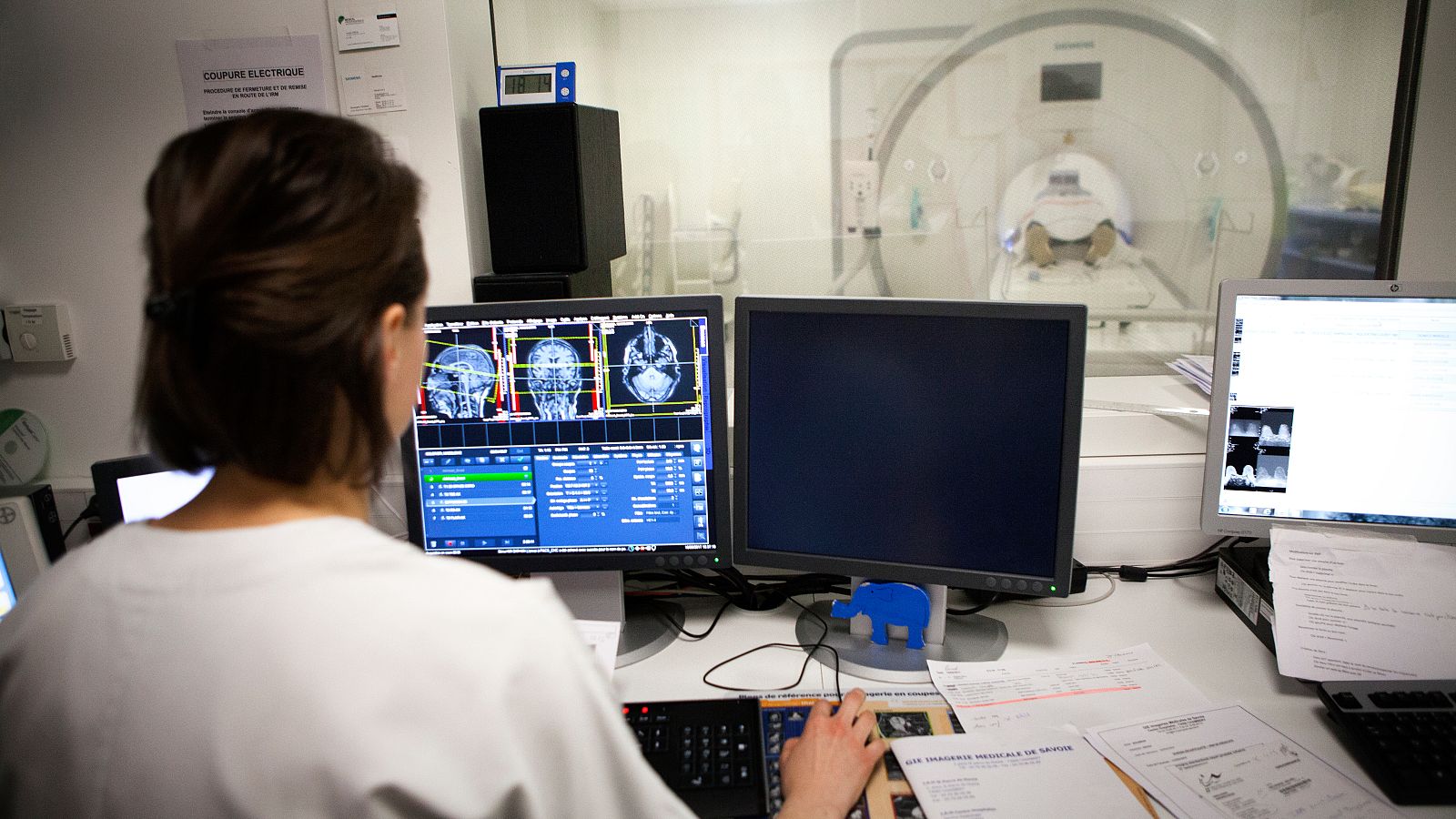 En España, la demencia frontotemporal afecta a un 0,2%-0,3% de la población mayor de 65 años.