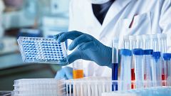 El tratamiento con vitamina B1 podría ser útil frente a la enfermedad de Huntington