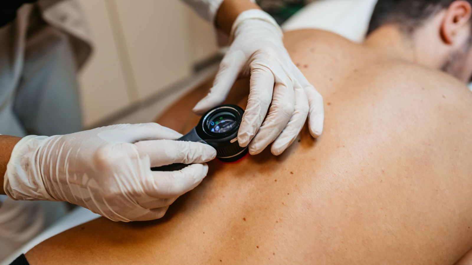 Una doctora examina las marcas en la piel de un paciente