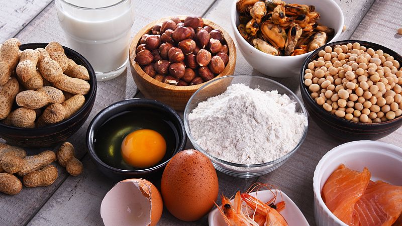 Los alimentos que m�s alergias producen y que, probablemente, no sab�as