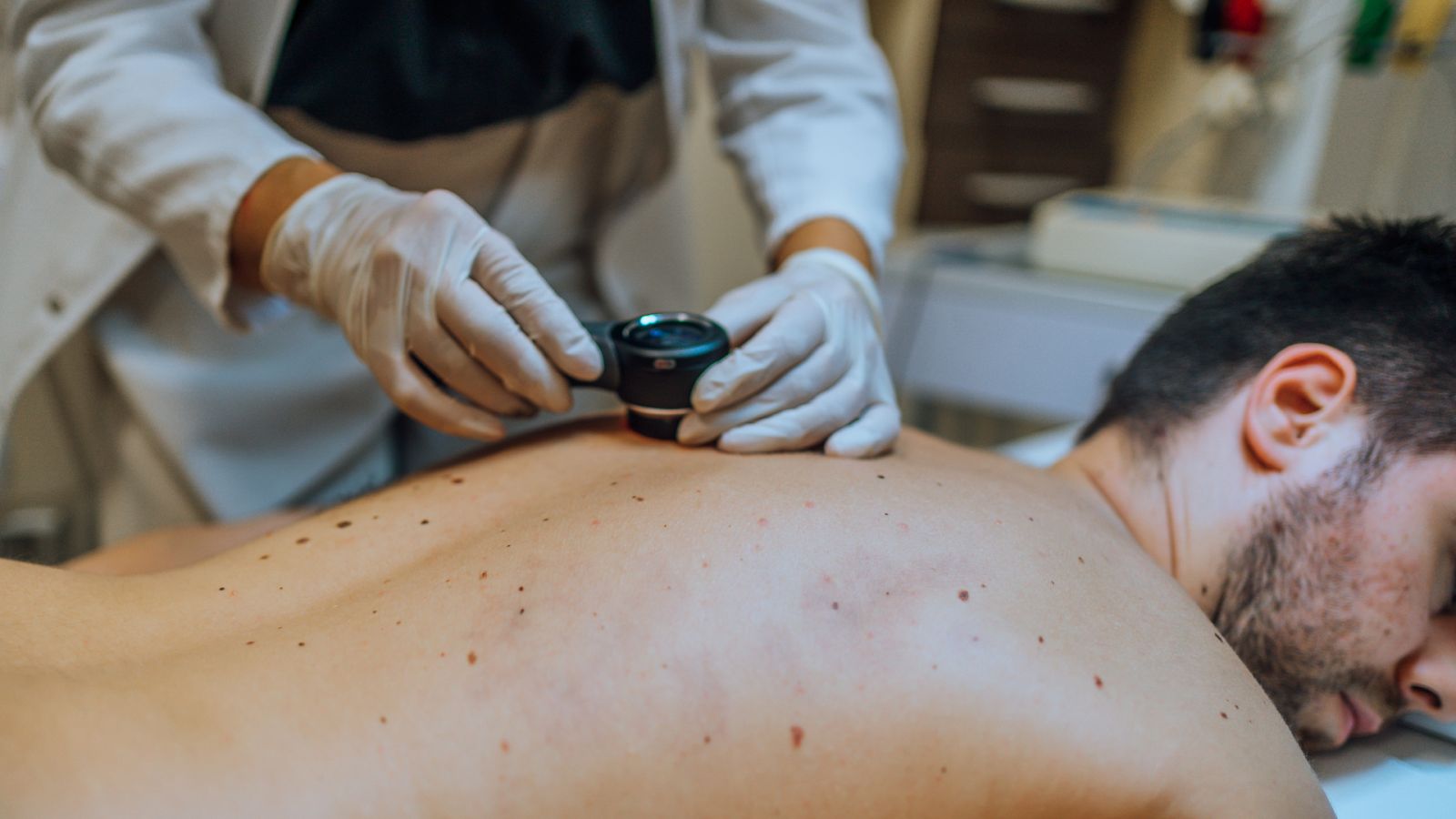 La nueva herramienta está enfocada a localizar las lesiones de la piel.