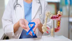 El cáncer de colon ha aumentado en personas jóvenes. Descubre los consejos del doctor Gonzalo Guerra para evitar padecerlo
