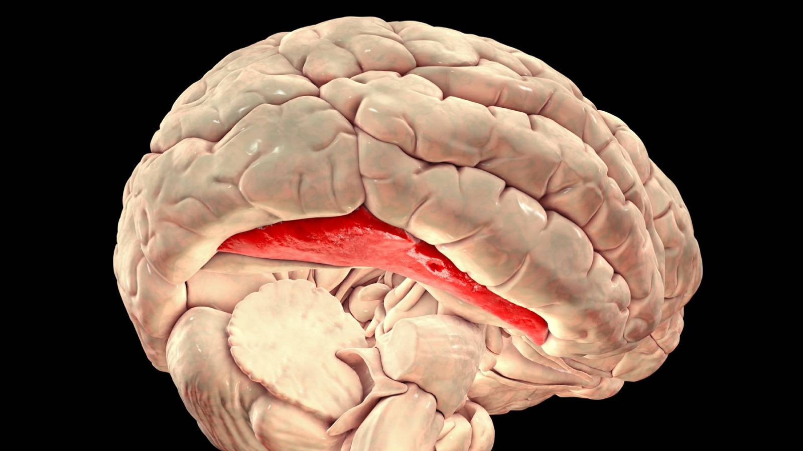 Cerebro prosopagnosia