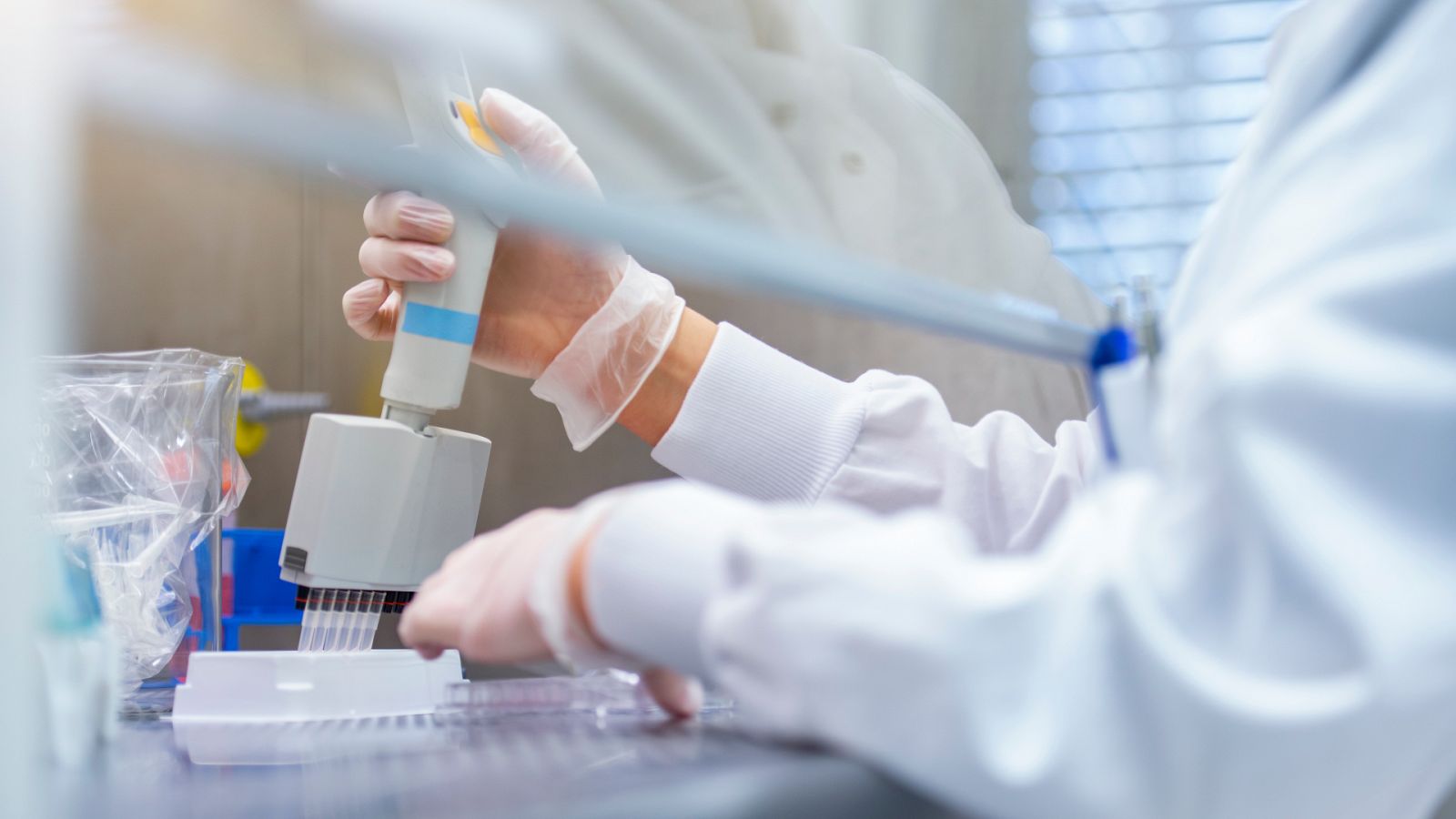 El virus de Marburgo es uno de los patógenos más peligrosos para el ser humano.