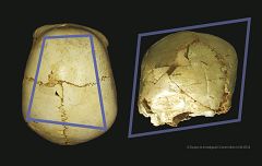 Hallan en Atapuerca un cráneo infantil de 530.000 años con una rara enfermedad congénita