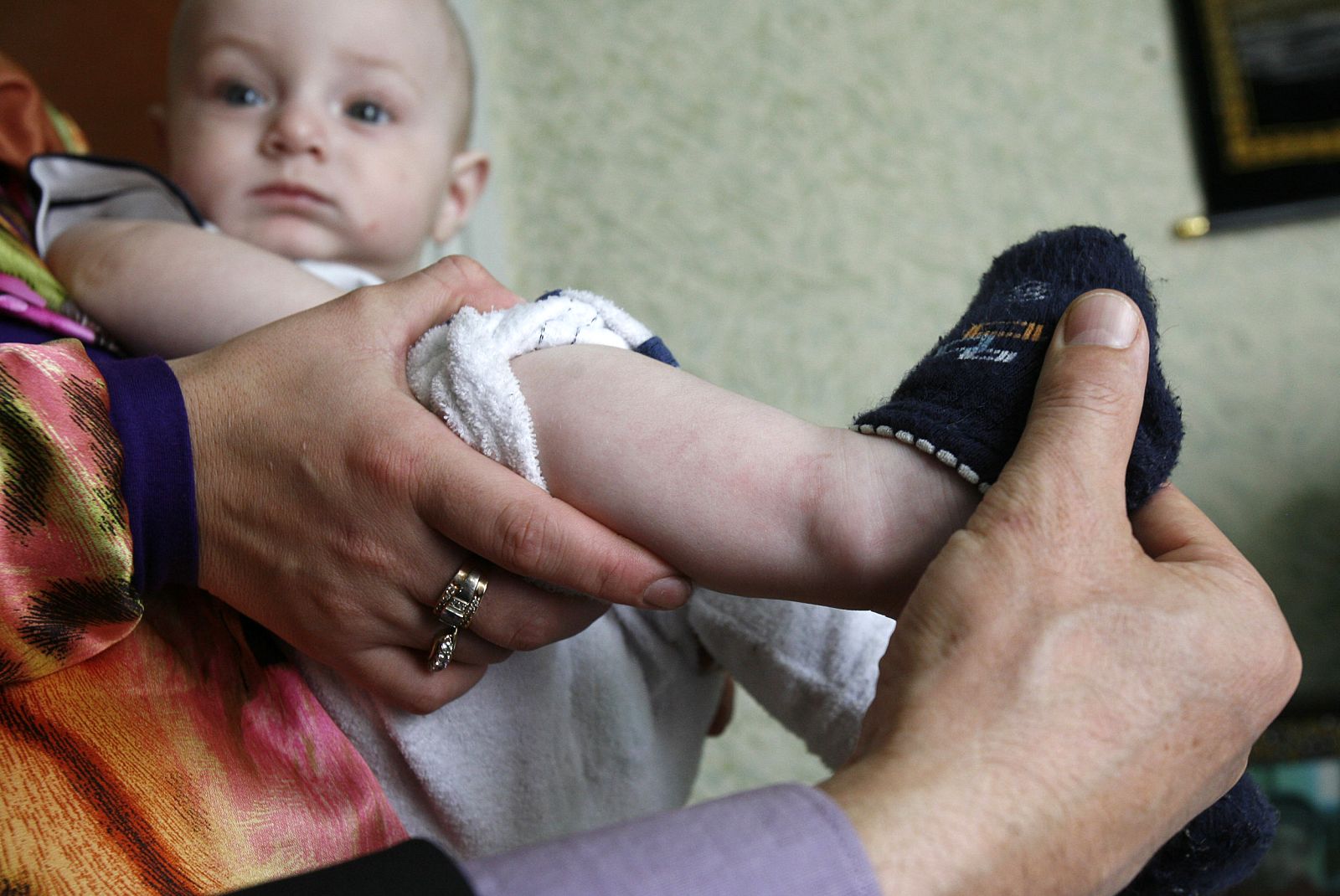 A pilgrim shows off the leg of baby Ali Yakubov at his house in Kizlyar in Russia's Dagestan Region