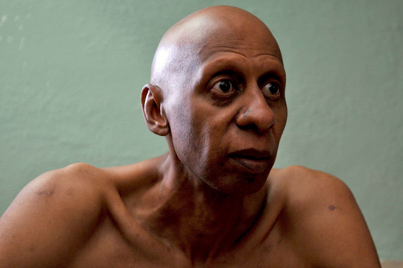 ESPAÑA OFRECE A FARIÑAS AVIÓN AMBULANCIA Y ÉL ACEPTARÁ SÓLO SI PUEDE VOLVER