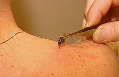Terapia con abejas