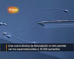 Un 'casting' de espermatozoides a 16.000 aumentos mejora las posibilidades de embarazo