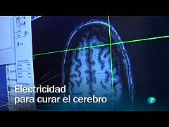 Contra el Alzheimer y el Parkinson, electrodos a la carta