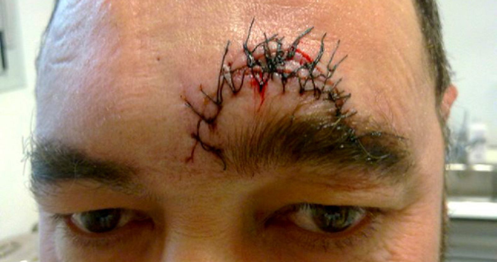 AGREDEN AL DUEÑO DE UN BAR CACEREÑO TRAS MEDIAR EN UNA PELEA POR EL TABACO