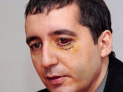 El consejero murciano agredido dice que se siente "como si hubiese vuelto a nacer"