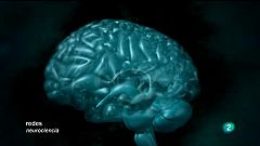 Redes - Antes y después de conocer el cerebro