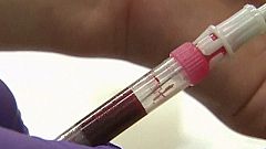 Nuevos análisis en la soja dan negativo y sigue la incógnita del origen del brote de 'E. coli'