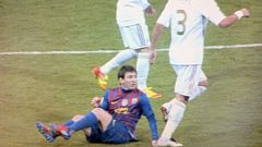 Pepe vuelve a mostrar su imagen más lamentable ante el Barça