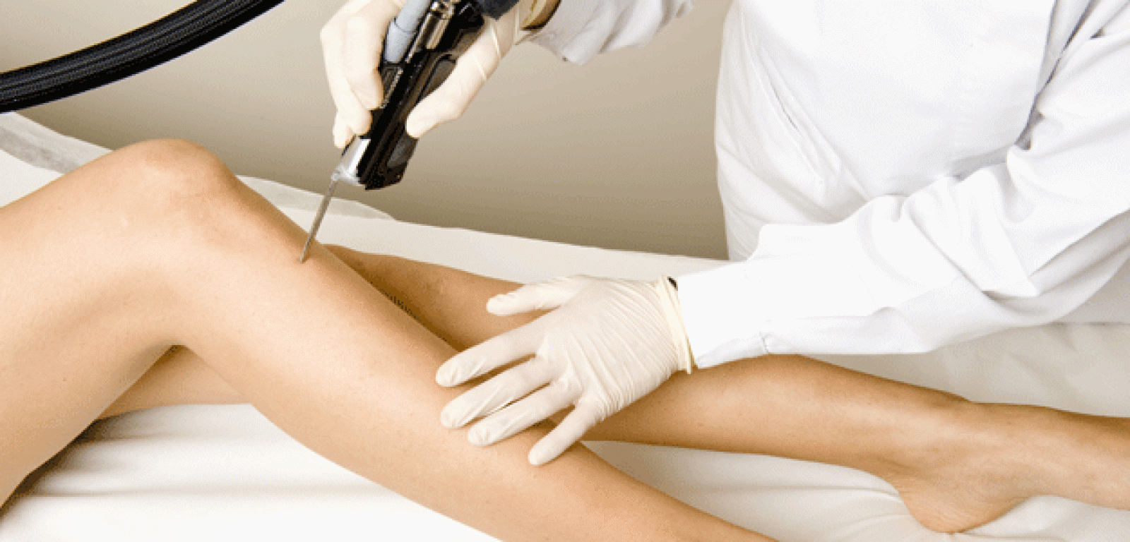 genete-foton-noticia-laser