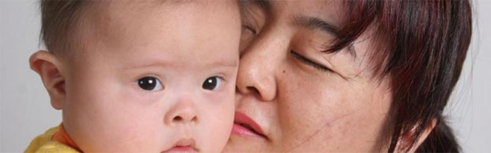 Un estudio de la Universidad de Massachussets demuestra que la introducción dentro del genoma humano del gen  XIST, podría corregir la trisomía del cromosoma 21,