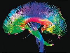 Demuestran que la actividad neuronal del cerebro se propaga a través de 'terremotos'