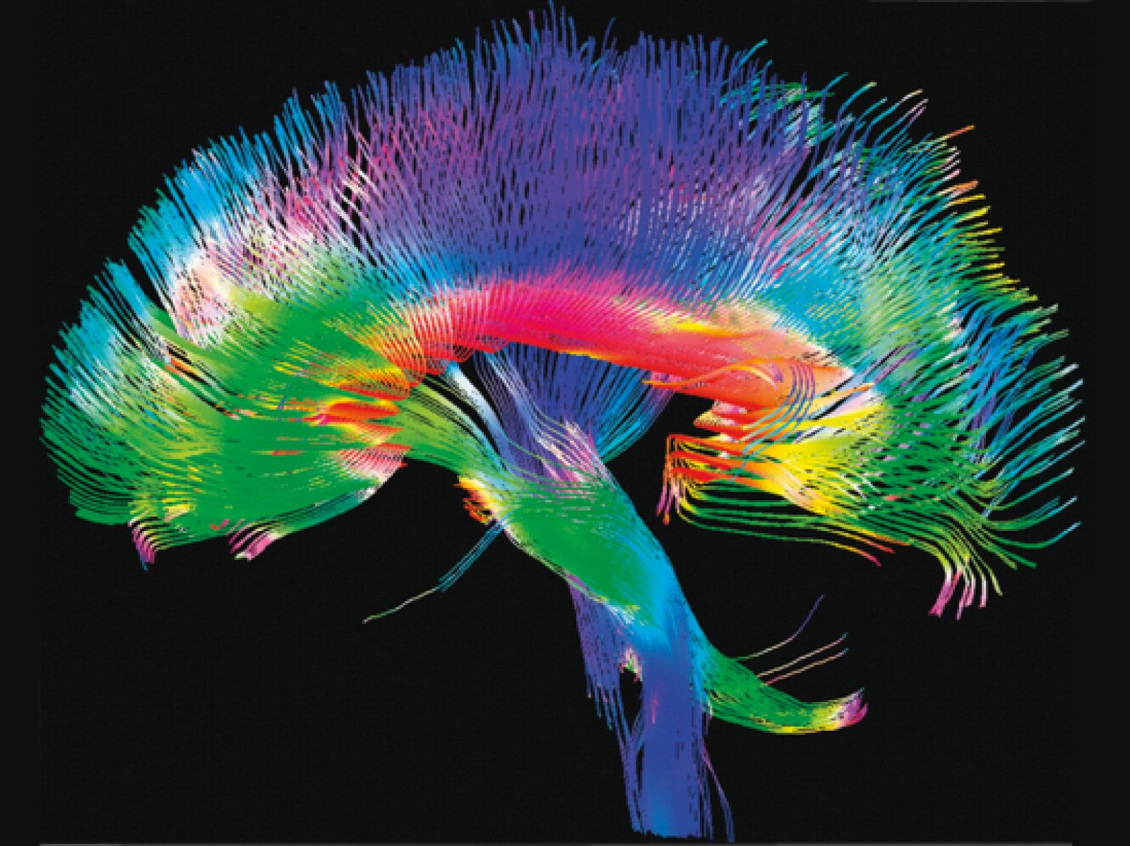 Figura original del 'Human Connectome Project'